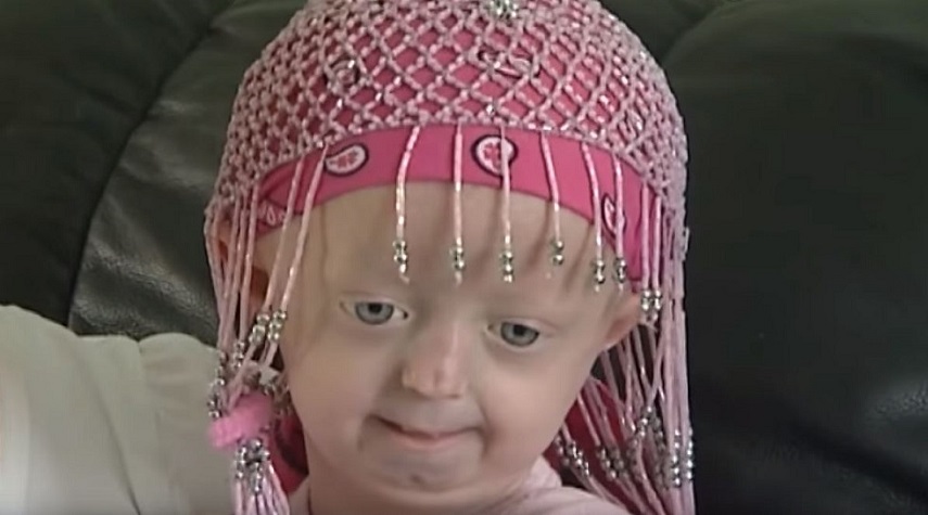 شيخوخة مبكرة  تؤدي لوفاة طفلة أوكرانية