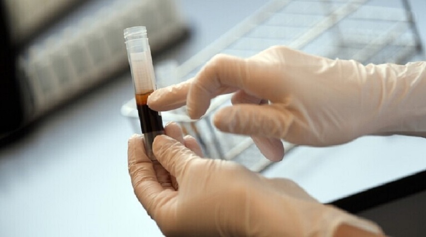 روسيا تبدأ انتاج دواء ضد كورونا يعتمد على بلازما الدم