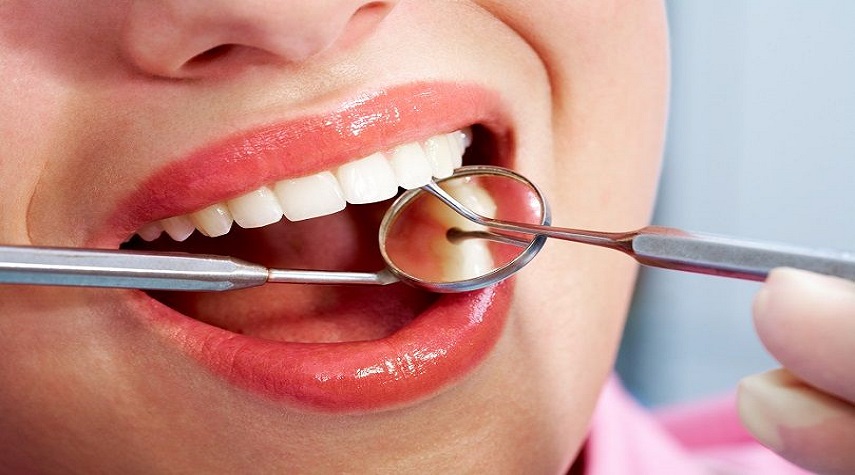"نقابة الأسنان": إعداد تسعيرة علاجية جديدة لأطباء الأسنان