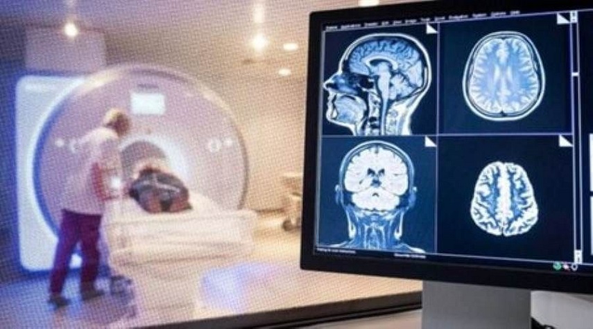 دراسة: "كوفيد" يمكن أن يسبب انكماشاً في الدماغ