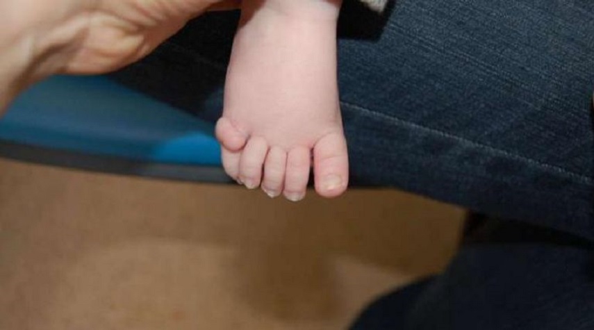 دراسة: تحديد طفرة جينية تتسبب بولادة أطفال بأصابع إضافية!