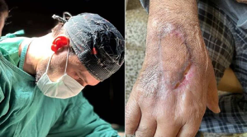 عمل جراحي ينقذ يد مريض وظيفياً في مشفى الباسل بطرطوس