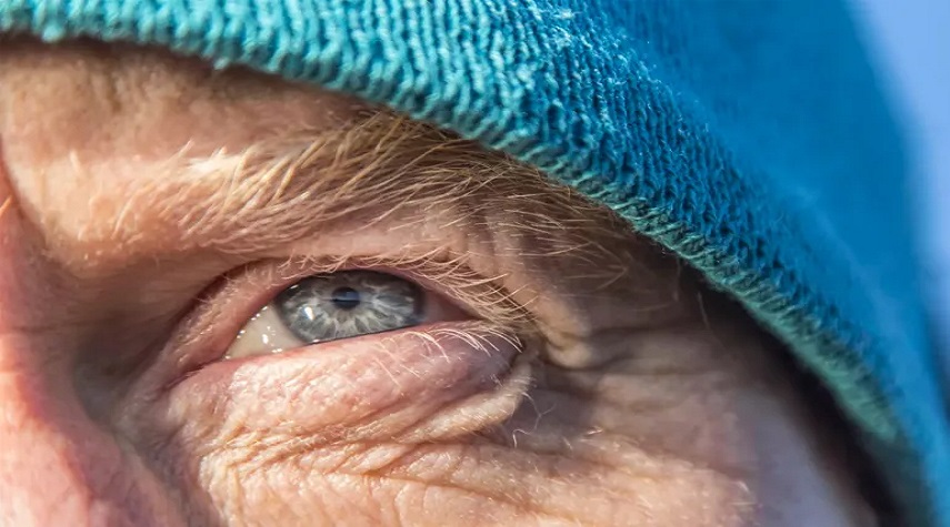 دراسة: مشاكل العين ممكن أن تؤدي للإصابة بالخرف